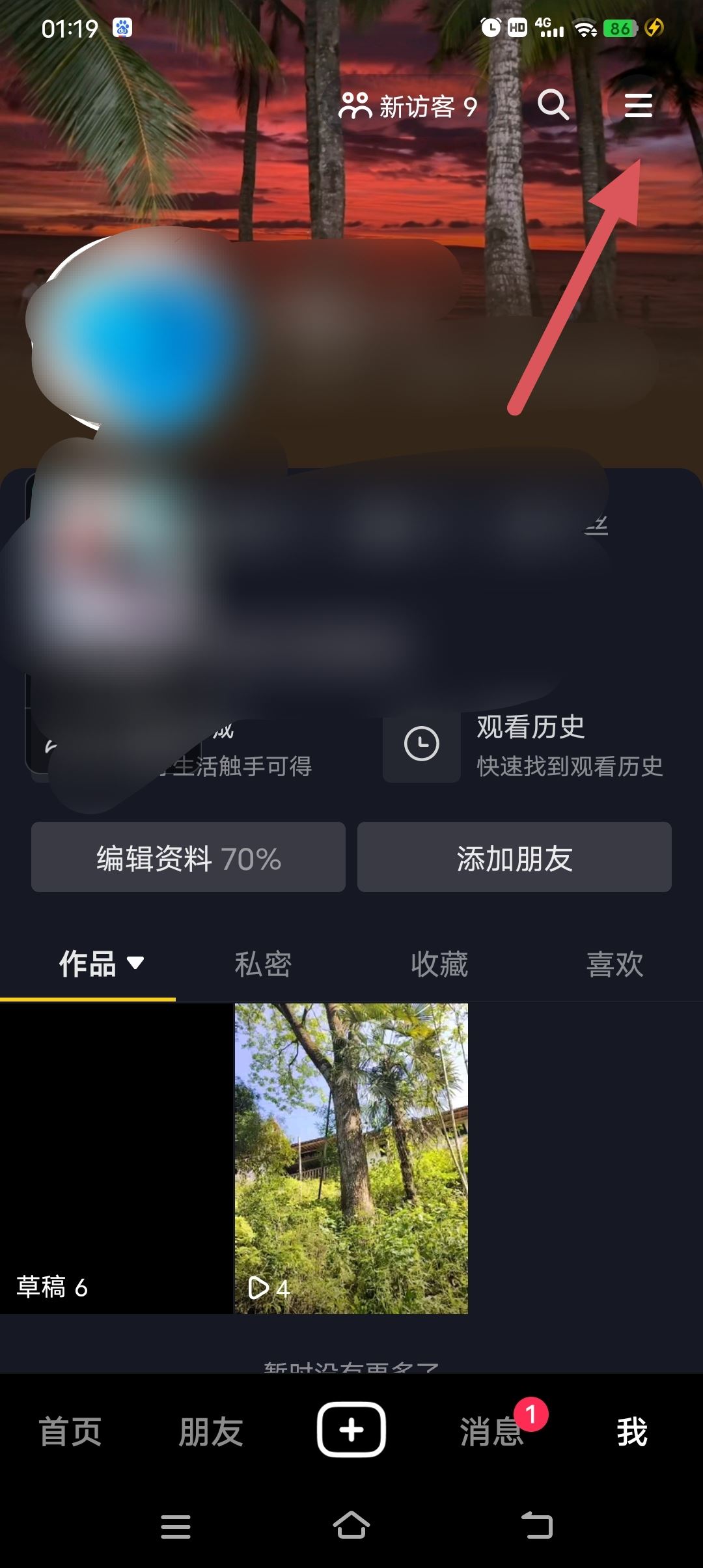 抖音自己發(fā)的作品怎樣無(wú)水印保存？