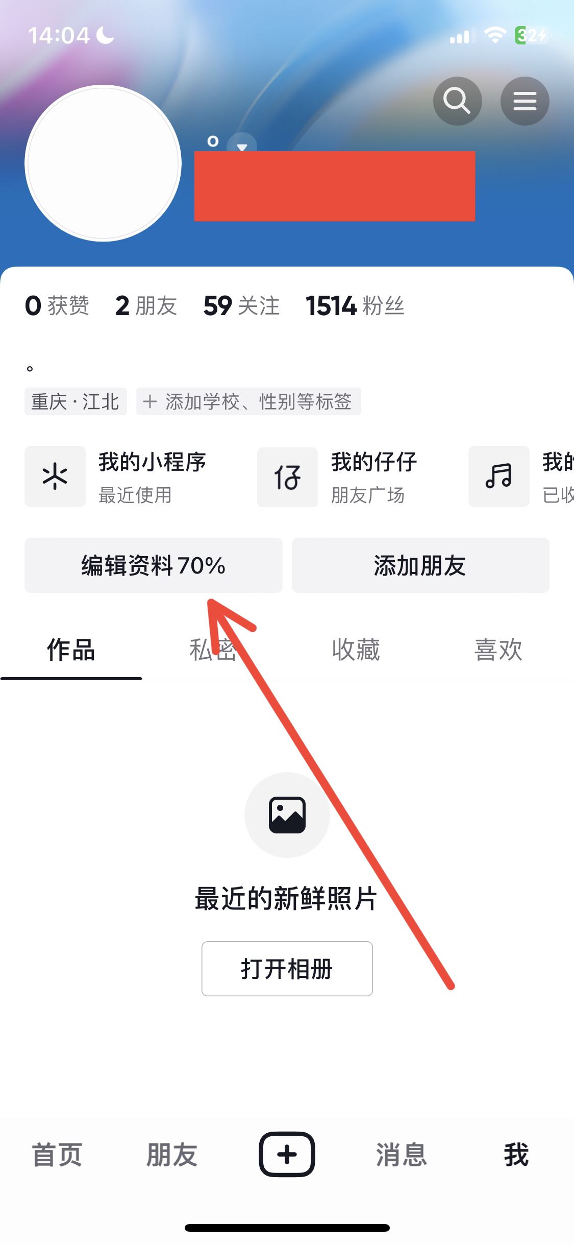 抖音30天只能修改4次名字怎么解除？