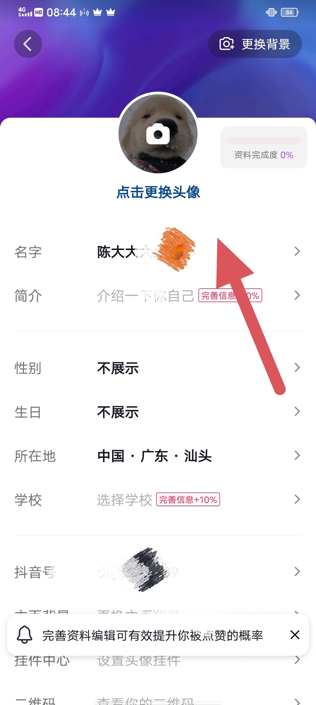 抖音30天只能修改4次名字怎么解除？