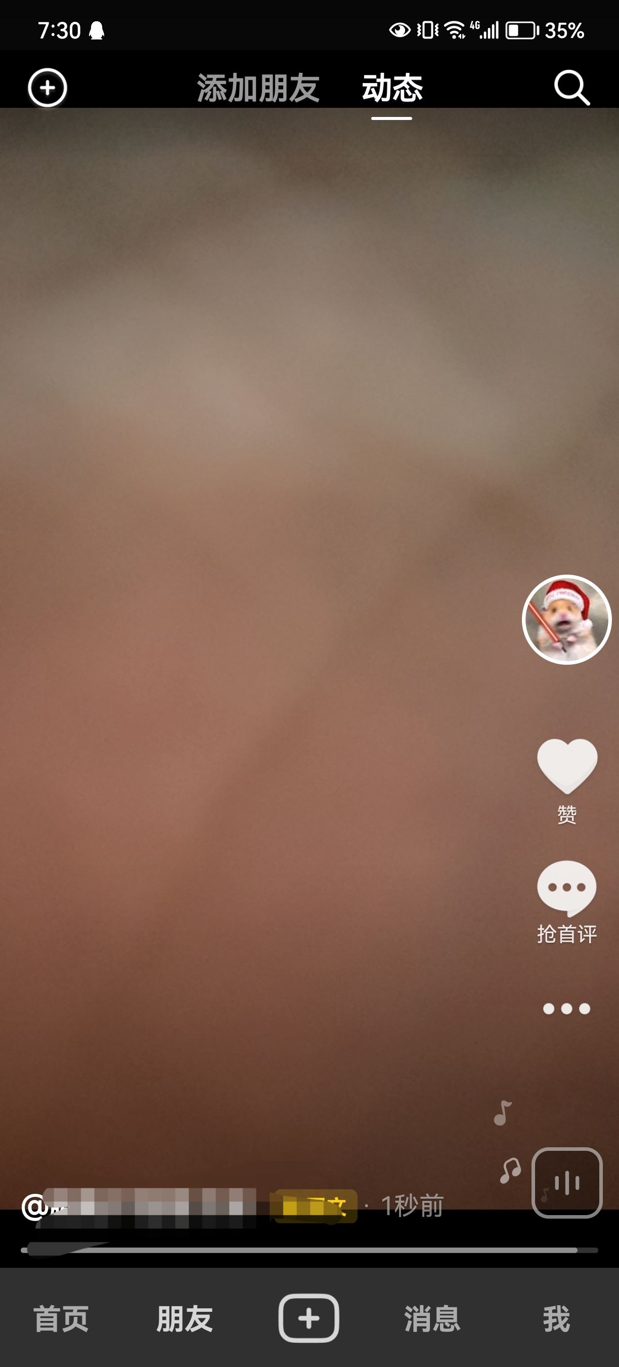 抖音發(fā)的日常怎么轉(zhuǎn)成永久？
